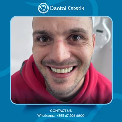 Slider image (1) Dental Estetik - Dental Clinic in Tirana, Albania